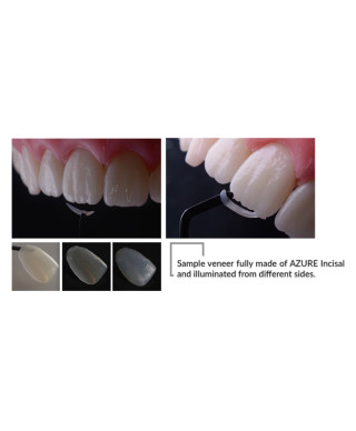 Azure Incisal