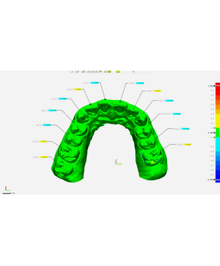 Shining 3D AoralScan 3 káblový