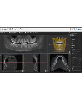 VistaVox S 3D